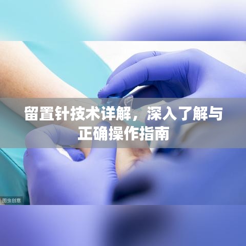 留置针技术详解，深入了解与正确操作指南