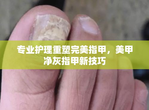 专业护理重塑完美指甲，美甲净灰指甲新技巧